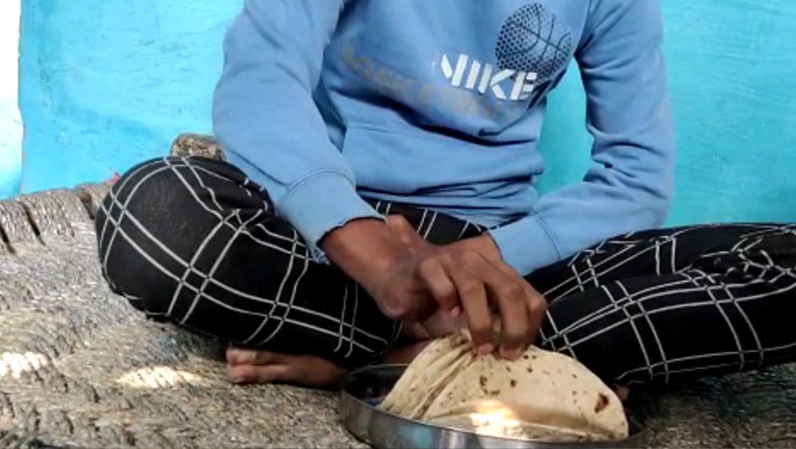 Boy Did Not Go To The Toilet For 18 Months Eats 18 To 20 Rotis Every Day