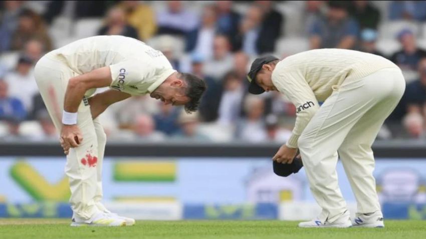 Ind Vs Eng Oval Test James Anderson Bowling With Bleeding Knee