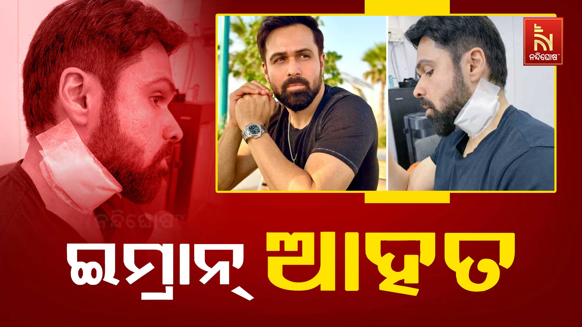 ଇମ୍ରାନ୍-ଆହତ