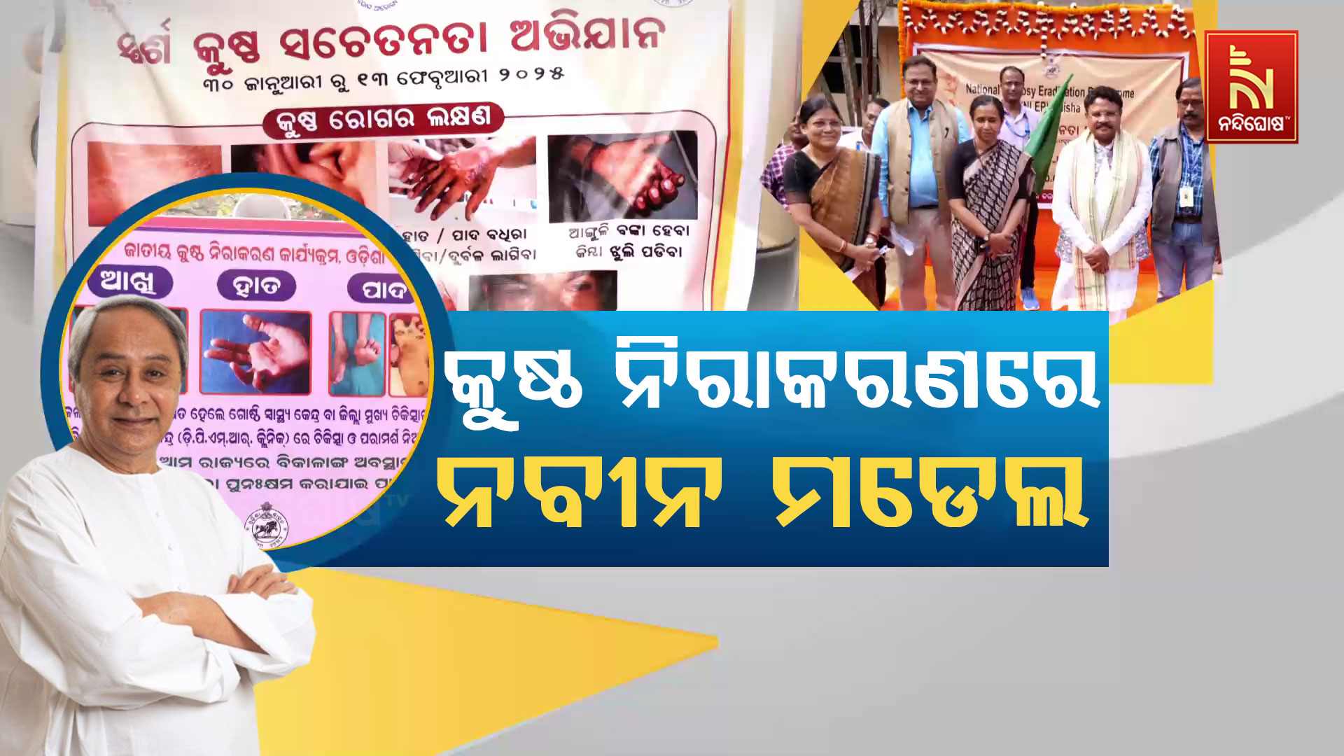 leprosy day
