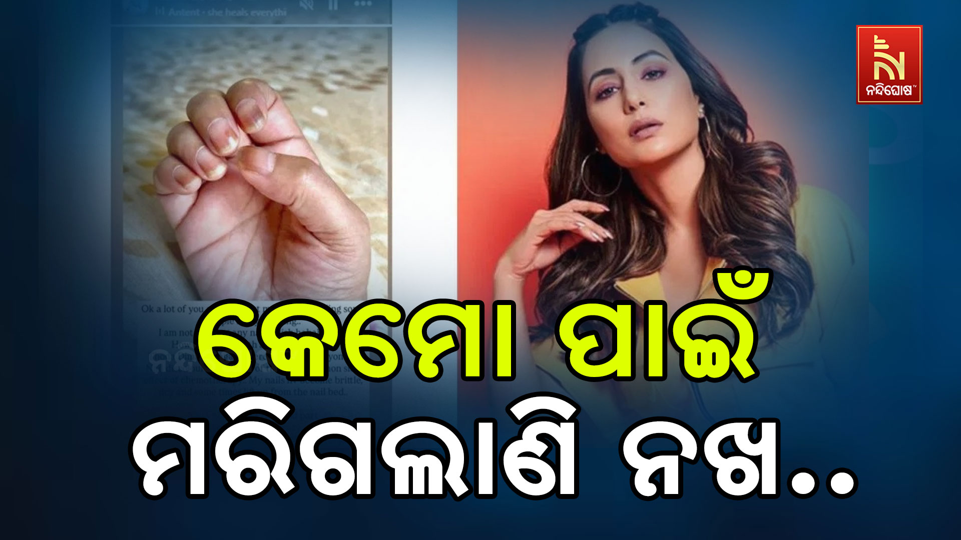 କେମୋ-ପାଇଁ-ମରିଗଲାଣି-ନଖ ..