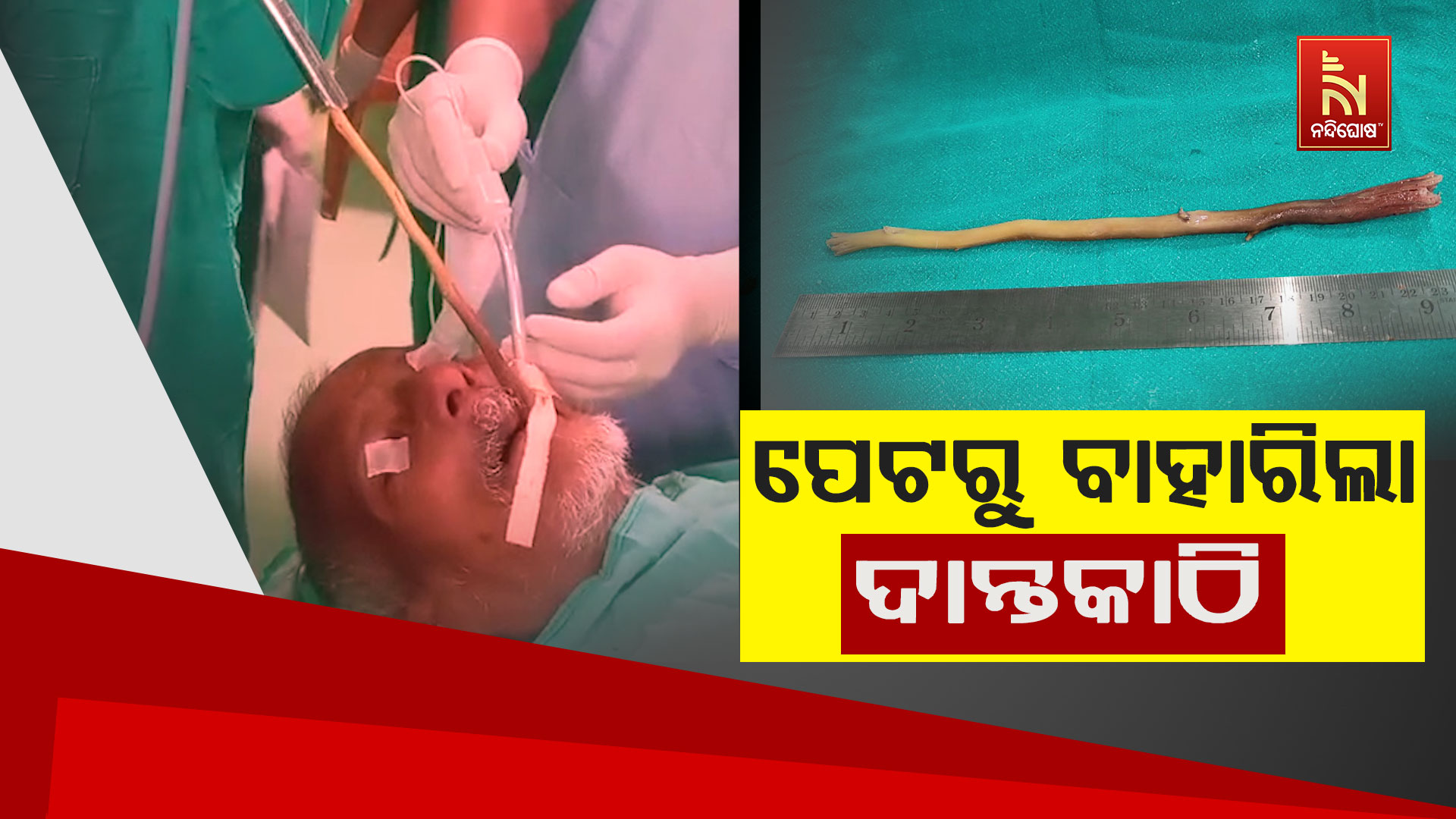 ପେଟରୁ-ବାହାରିଲା-ଦାନ୍ତକାଠି