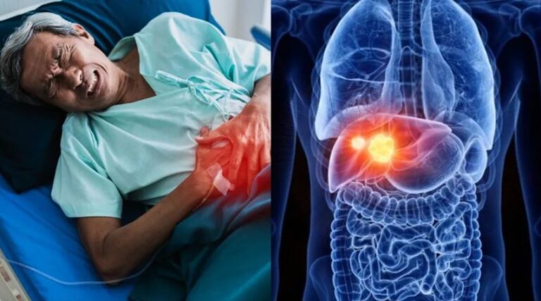 ଏହି ୫ଟି ଫୁଡସ୍ ଲିଭରକୁ ଡ୍ୟାମେଜ କରିପାରେ